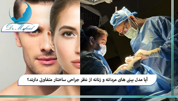 مدل بینی (4)