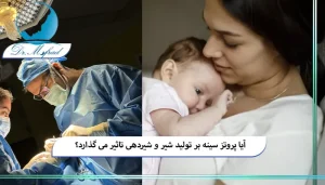 آیا پروتز سینه واقعا شیردهی را مختل می کند؟
