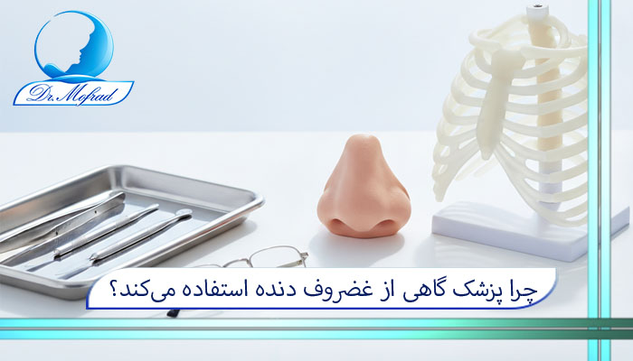 چرا پزشک گاهی از غضروف دنده استفاده میکند؟