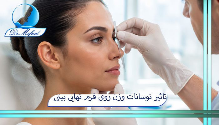 تاثیر نوسانات وزن روی فرم نهایی بینی 