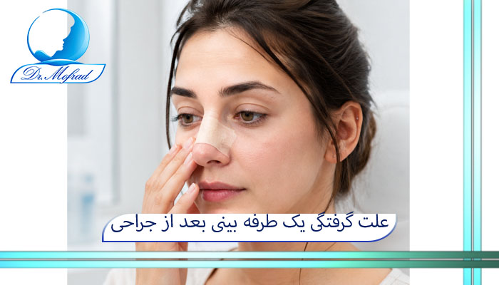 علت گرفتگی یک طرفه بینی بعد از جراحی