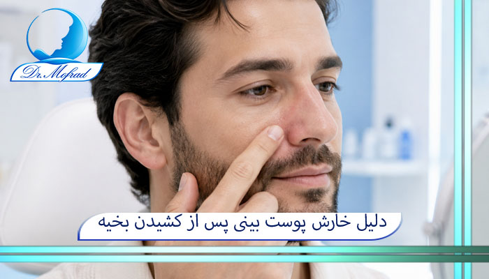دلیل خارش پوست بینی پس از کشیدن بخیه‌ها