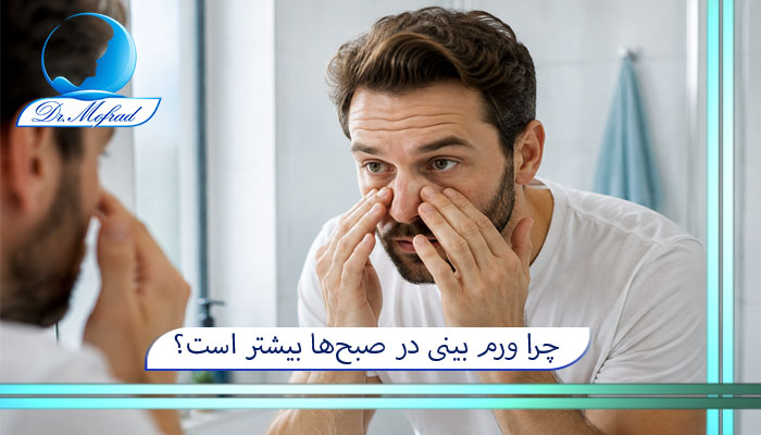 چرا ورم بینی در صبحها بیشتر است؟