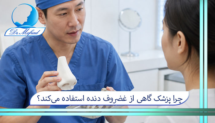 چرا پزشک گاهی از غضروف دنده استفاده میکند؟