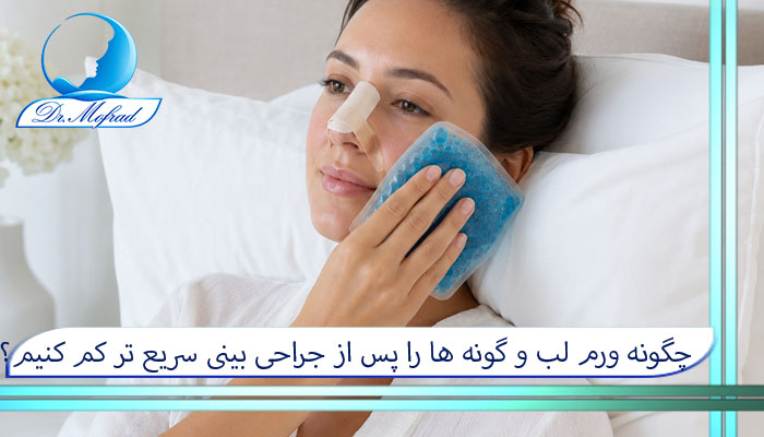 چگونه ورم لب و گونه ها را بعد از جراحی بینی کم کنیم؟