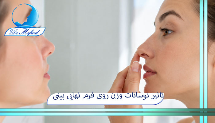 تاثیر نوسانات وزن روی فرم نهایی بینی 