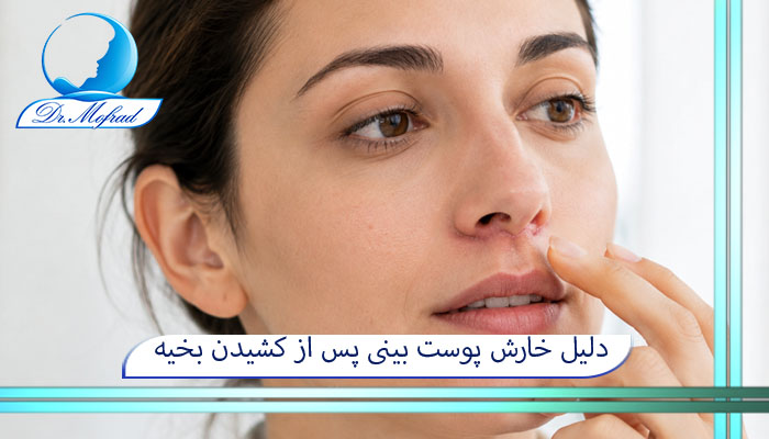 دلیل خارش پوست بینی پس از کشیدن بخیه‌ها