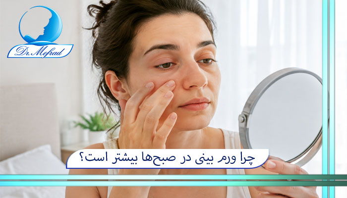 چرا ورم بینی در صبحها بیشتر است؟