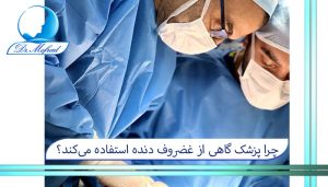 چرا پزشک گاهی از غضروف دنده استفاده میکند؟