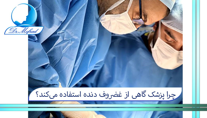 چرا پزشک گاهی از غضروف دنده استفاده می‌کند؟