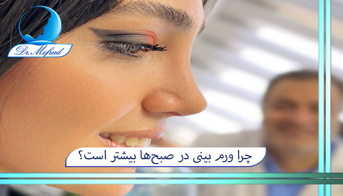 چرا ورم بینی در صبح‌ها بیشتر است؟
