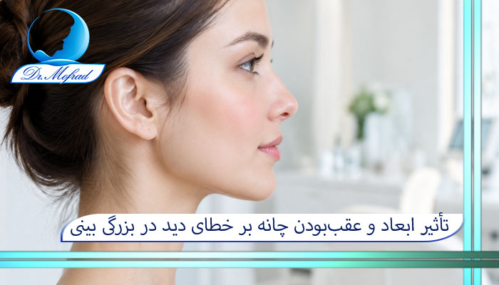 تأثیر ابعاد و عقببودن چانه بر خطای دید در بزرگی بینی (پروفیلوپلاستی)