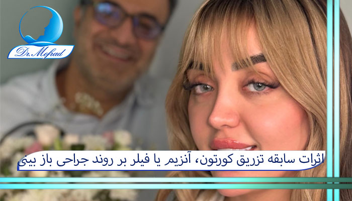 اثرات سابقه تزریق کورتون، آنزیم یا فیلر بر روند جراحی باز بینی