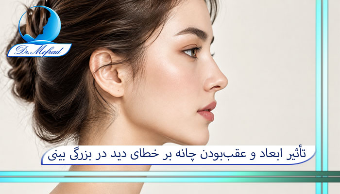 تأثیر ابعاد و عقببودن چانه بر خطای دید در بزرگی بینی (پروفیلوپلاستی)
