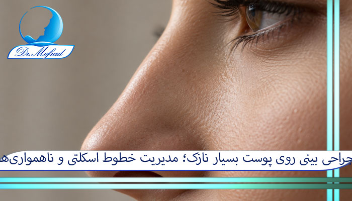 جراحی بینی روی پوست بسیار نازک؛ مدیریت خطوط اسکلتی و ناهمواریها