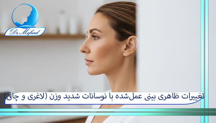 تغییرات ظاهری بینی عمل‌شده با نوسانات شدید وزن (لاغری و چاقی)