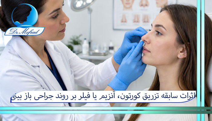 اثرات سابقه تزریق کورتون، آنزیم یا فیلر بر روند جراحی باز بینی