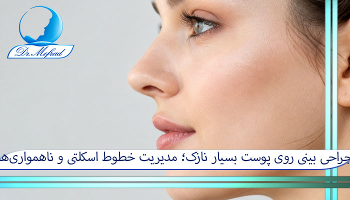 جراحی بینی روی پوست بسیار نازک؛ مدیریت خطوط اسکلتی و ناهمواریها