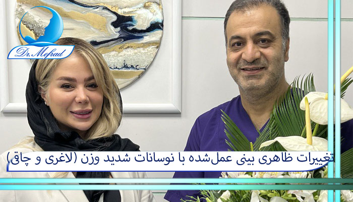 تغییرات ظاهری بینی عمل‌شده با نوسانات شدید وزن (لاغری و چاقی)