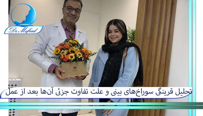 تحلیل قرینگی سوراخ‌های بینی و علت تفاوت جزئی آن‌ها بعد از عمل