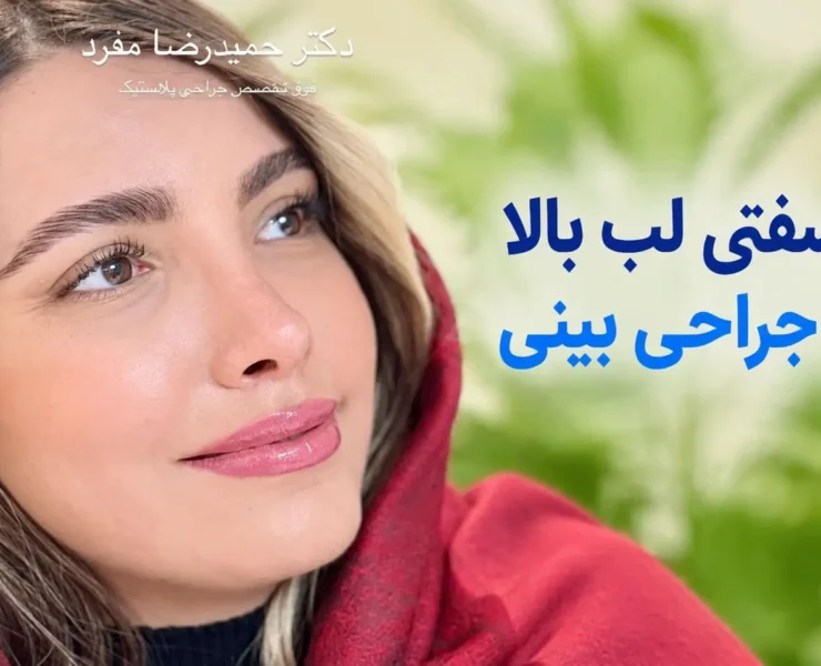 علت سفتی لب بالا بعد از جراحی بینی
