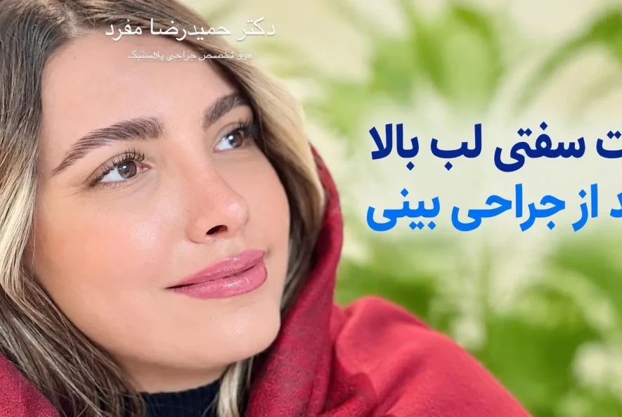 علت سفتی لب بالا بعد از جراحی بینی