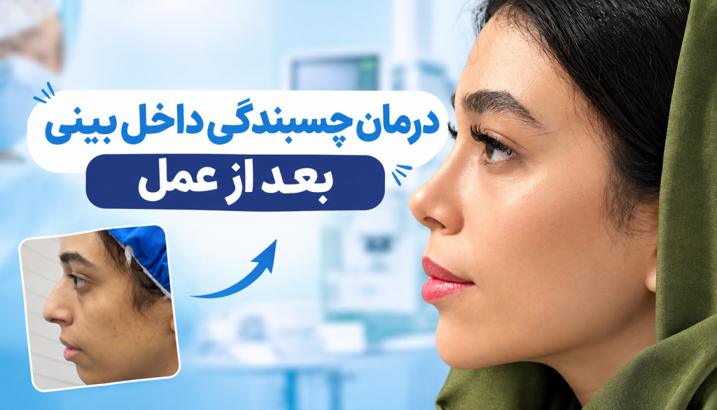 درمان چسبندگی داخل بینی بعد از عمل