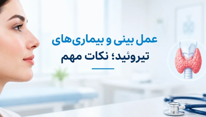 عمل بینی و بیماریهای تیروئید؛ نکات مهم