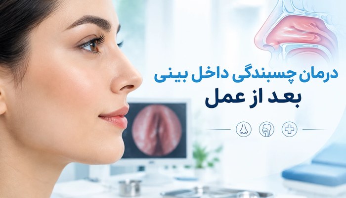 درمان چسبندگی داخل بینی بعد از عمل