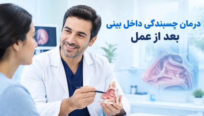 درمان چسبندگی داخل بینی بعد از عمل
