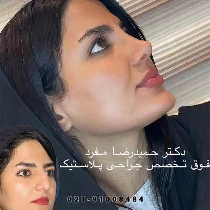 نمونه کار