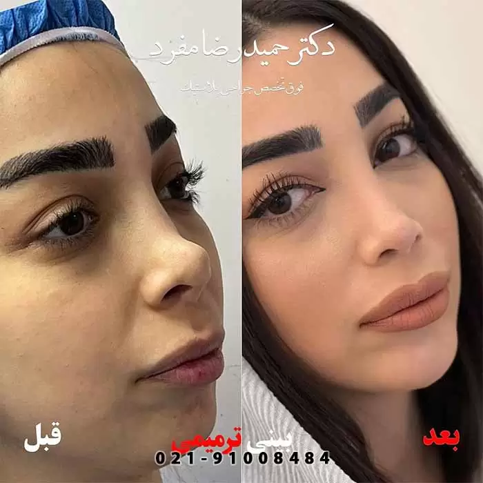 نمونه