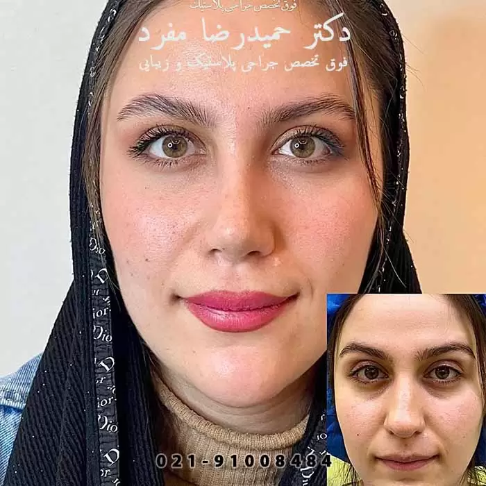 نمونه کار