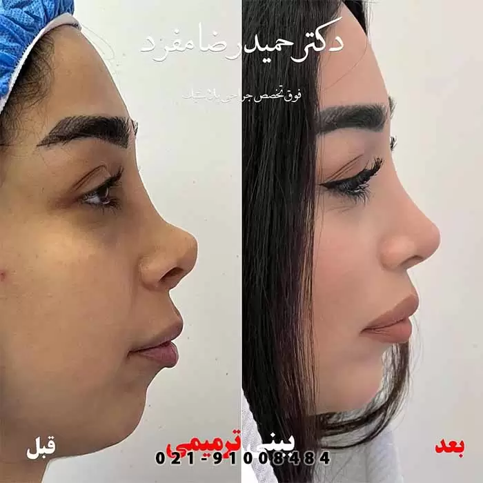 ترمیمی