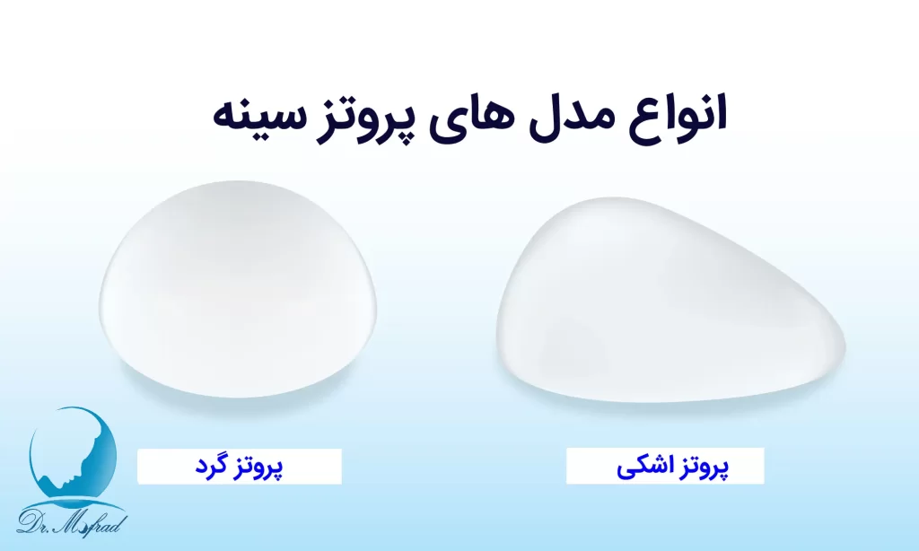 پروتز سینه