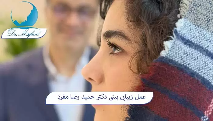 عمل جراحی بینی در تهران