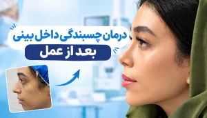 درمان چسبندگی داخل بینی بعد از عمل